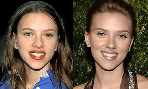 Best Plastic Surgeries Before And After