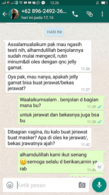 obat benjolan dibawah lidah obat benjolan dibawah lidah