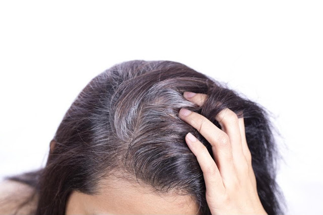 Những nguyên nhân làm tóc bạc sớm ở giới trẻ hiện nay 1 Những nguyên nhân làm tóc bạc sớm ở giới trẻ hiện nay 1