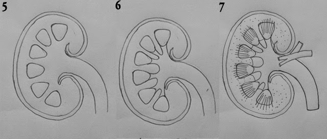 DRAW IT NEAT : How to draw LS of kidney