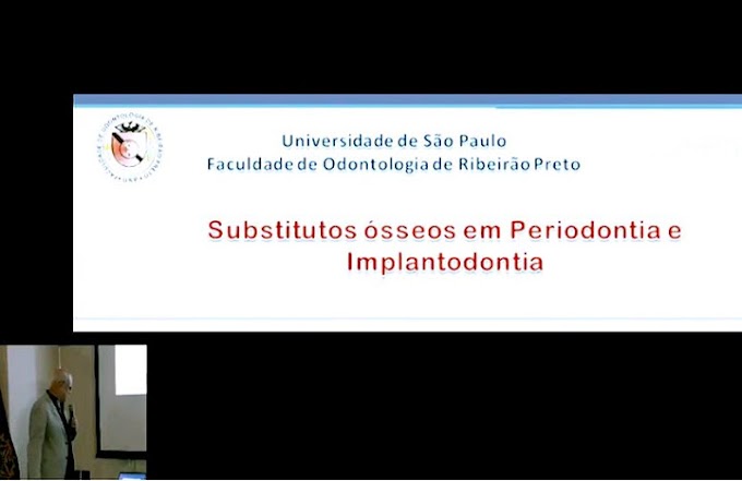 VIDEOCONFERÊNCIA: Substitutos Ósseos em Periodontia e Implantodontia - Dr. Arthur Belém