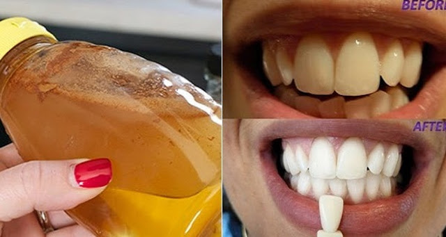 HAGA GÁRGARAS CON UN SIMPLE INGREDIENTE Y VER QUÉ PASA A LOS DIENTES HAGA GÁRGARAS CON UN SIMPLE INGREDIENTE Y VER QUÉ PASA A LOS DIENTES