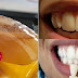 HAGA GÁRGARAS CON UN SIMPLE INGREDIENTE Y VER QUÉ PASA A LOS DIENTES