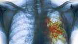 Animals like cats, ferrets, lions and cows can carry Tuberculosis (TB) and pass it onto humans Animals like cats, ferrets, lions and cows can carry Tuberculosis (TB) and pass it onto humans