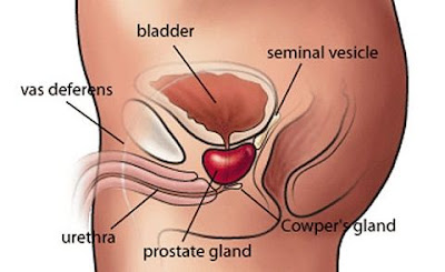 psa in aumento nel carcinoma della prostata