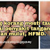 Info yang korang mesti tau mengenai penyakit tangan, kaki dan mulut, HFMD. 