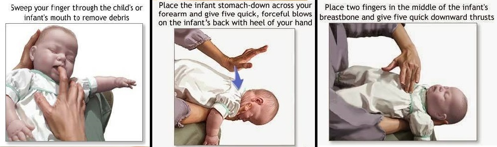 Cara Pijatan Untuk Anak tersedak air liur