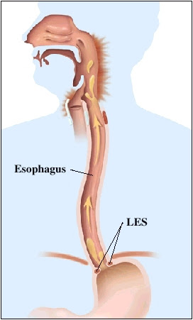 SURGSEMINAR: Esophagus 1 Anatomy