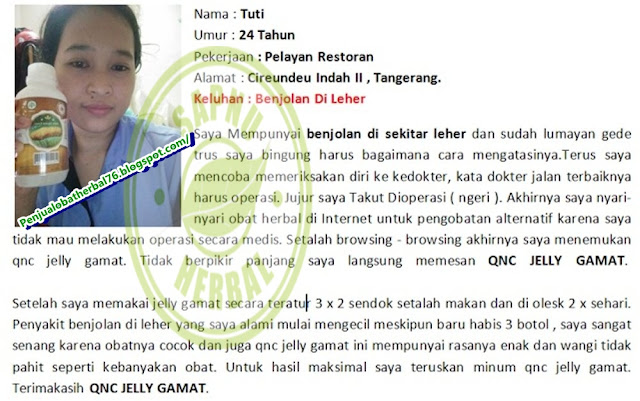 Cara Mengobati Gondok Secara Alami Dan Paling Ampuh Cara Mengobati Gondok Secara Alami Dan Paling Ampuh