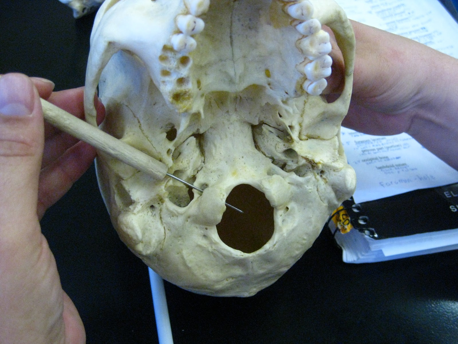 Boned: Human Skull - hypoglossal canal (of occipital bone)