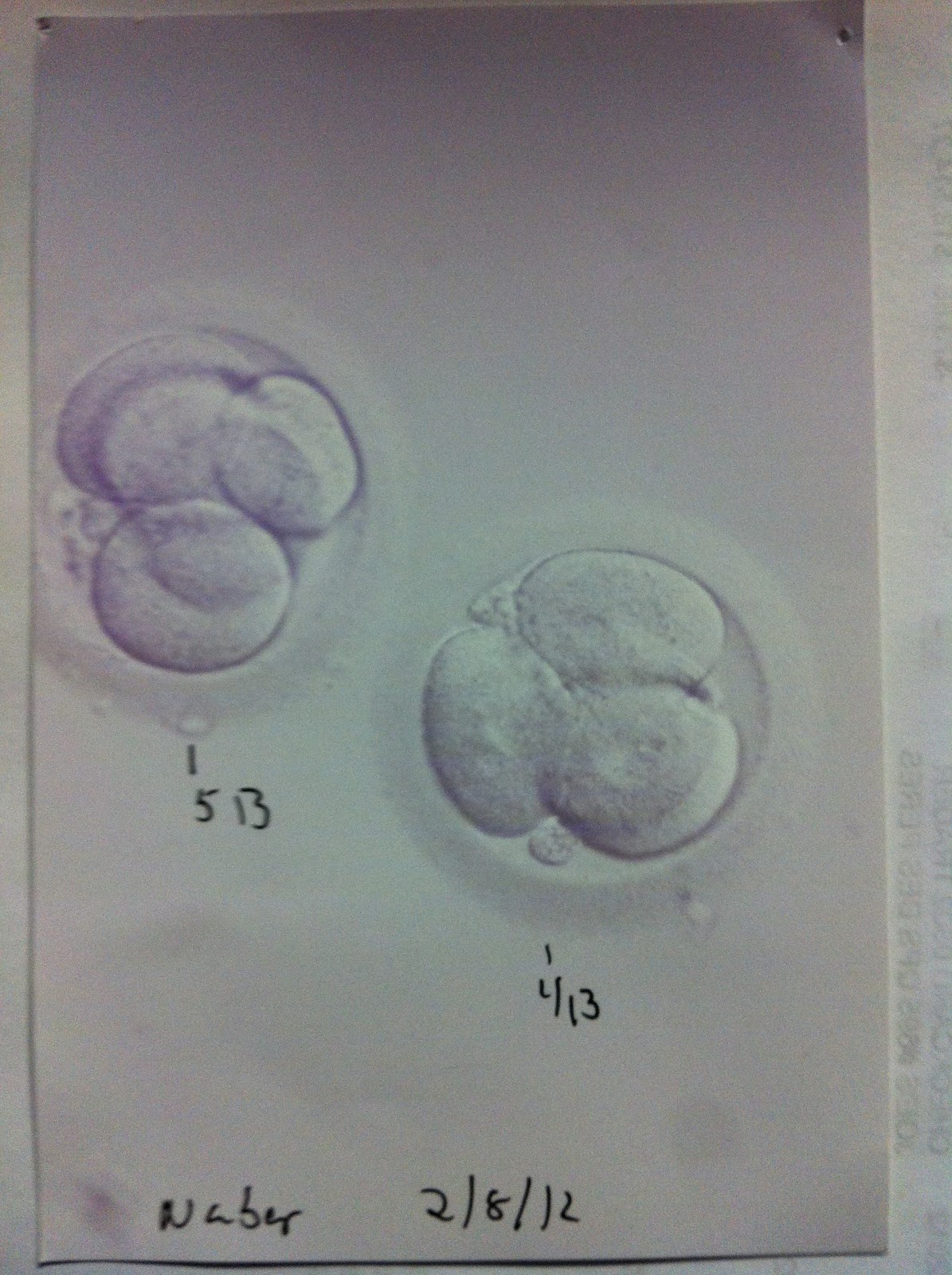 Our journey to be parents Each week is something new!