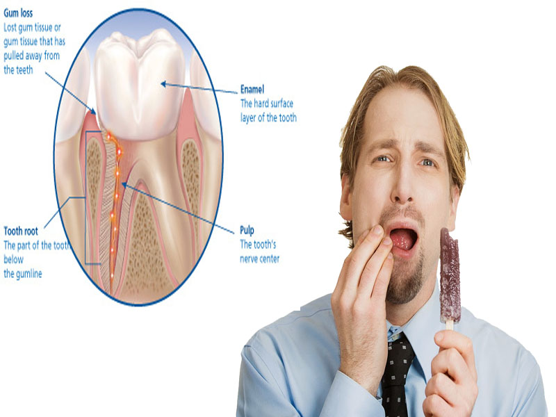 Teeth Sensitivity Emergency Of Dentist