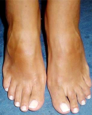 Pies Foto de pies femeninos