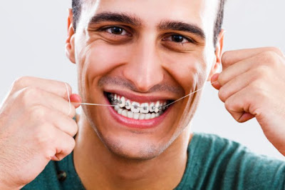Chỉ bạn cách vệ sinh răng miệng sau khi niềng răng hợp lý 2