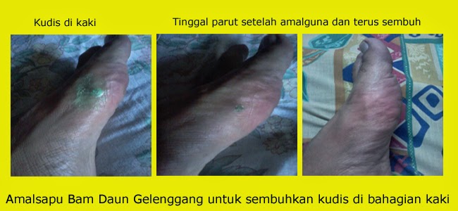 Cara Ubat Ulser Mulut Kucing  Mengapa q