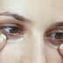 Baking Soda Mask Against Eye Bags, Dark Circles And Swollen Eyelids – RECIPE