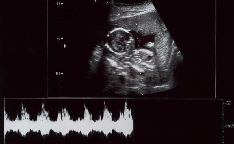 Illinois Federation for Right to Life Bill banning abortion from baby’s first heartbeat