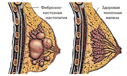 купить артлайф Артлайф Беларусь в Гомеле, Минске, Бресте, Могилеве, Витебске, Гродно