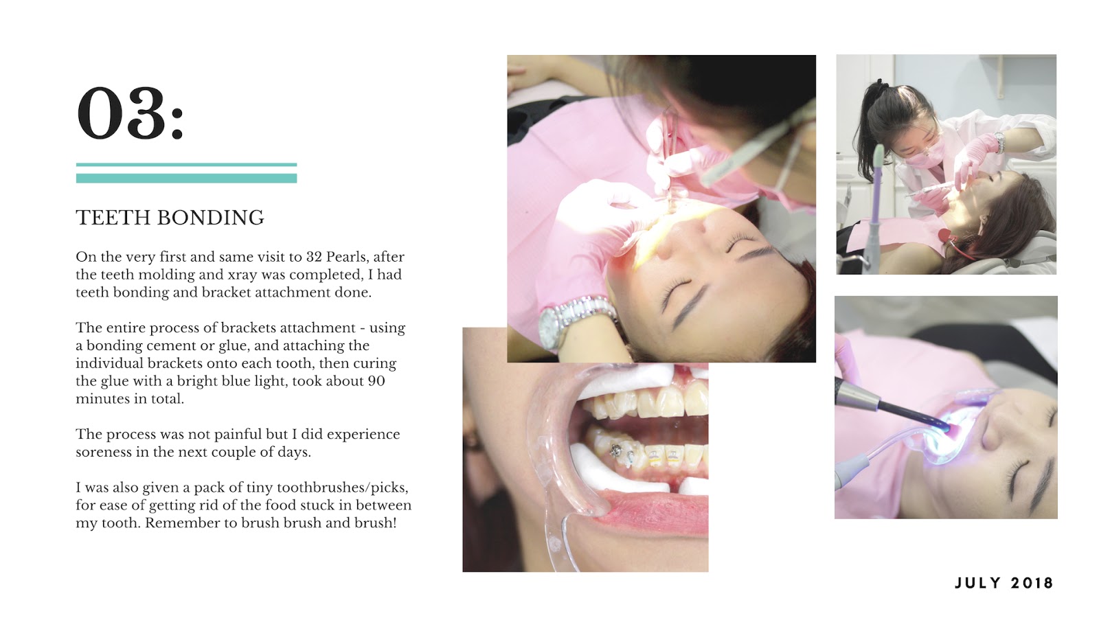 dental clinic in damansara pj ttdi kl 32 pearls dental clinic review