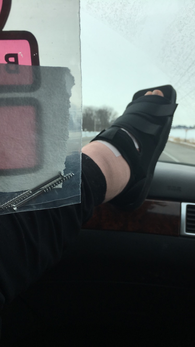 Sarah House 365 My Ankle Hardware Removal