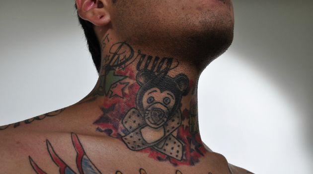 Duele el cuello detrás a la derecha la garganta a la derecha