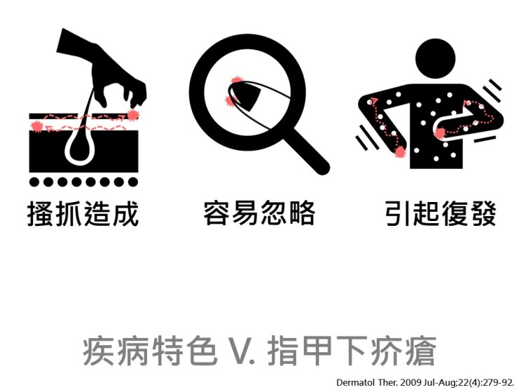 疥瘡疾病特色 指甲下疥瘡–照護線上, scabies - CareOnline