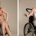 Cette jeune femme handicapée pose en petite lingerie pour montrer que tous les corps sont beaux.