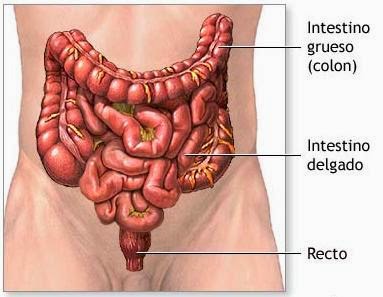 inflamación del colon