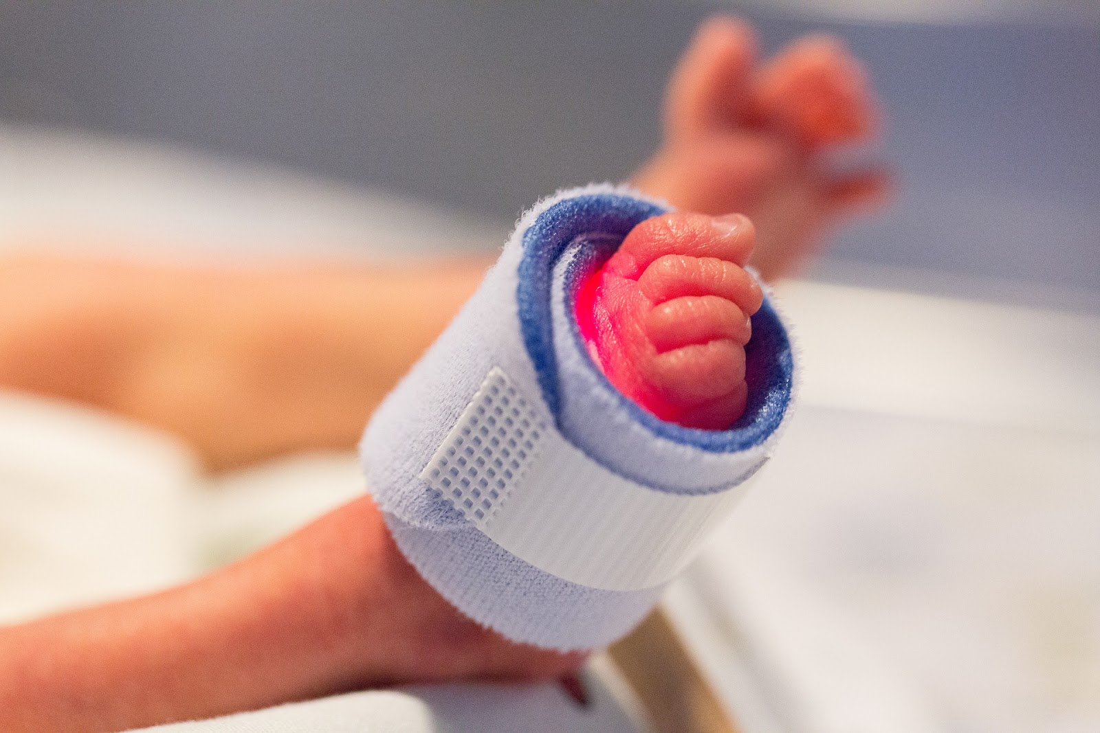 fasceíte plantar edema da medula