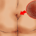 DO NOT IGNORE THIS! THIS MAY BE THE HIDDEN REASON OF YOUR LOWER BACK PAIN