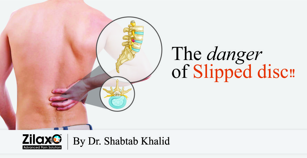 Zilaxo Advanced Pain Solution The Danger Of Slipped Disc