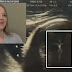 Aparece la imagen de Jesús en un ultrasonido de una mujer de USA