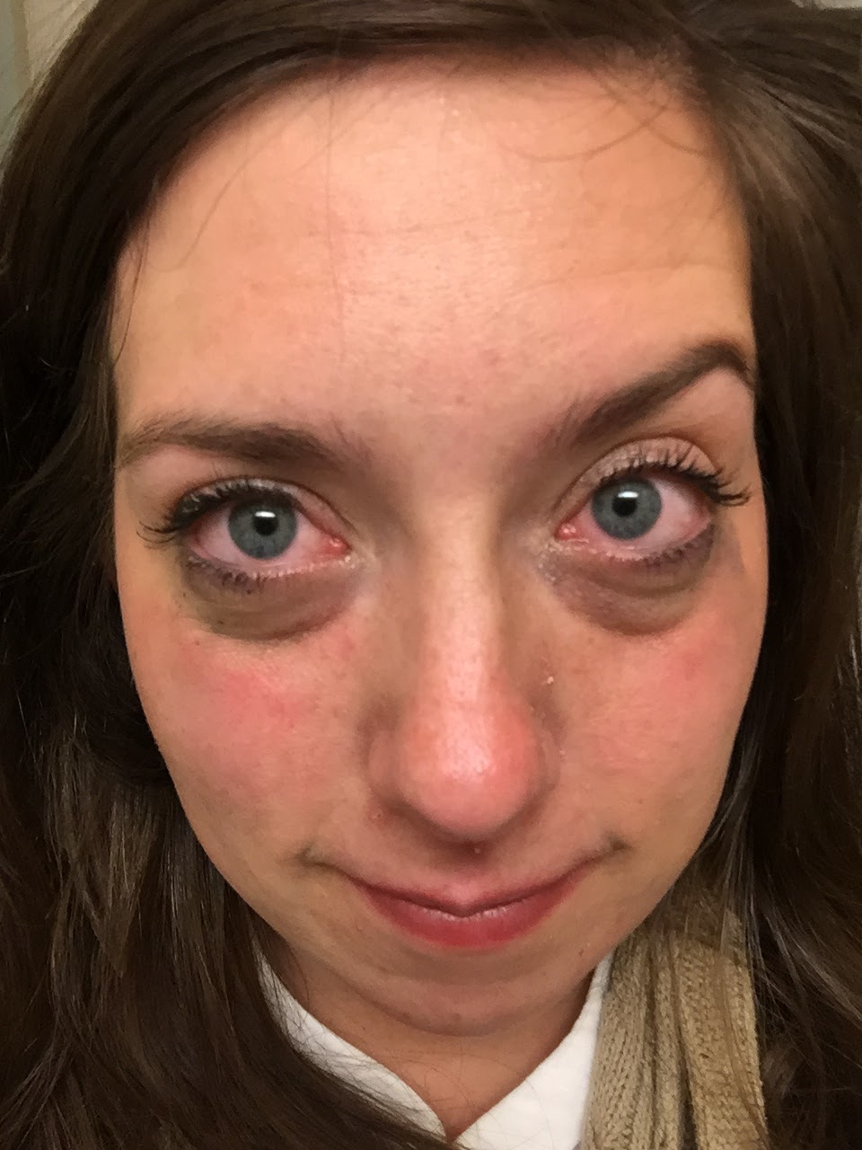 How To Describe Eyes After Crying slidesharetrick