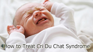 How to Treat Cri Du Chat Syndrome How to Treat Cri Du Chat Syndrome