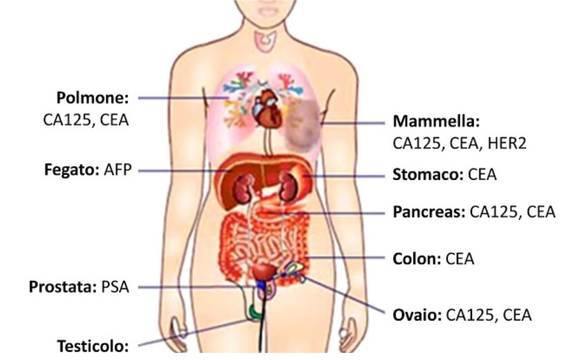 marcatori tumorali prostata valorita