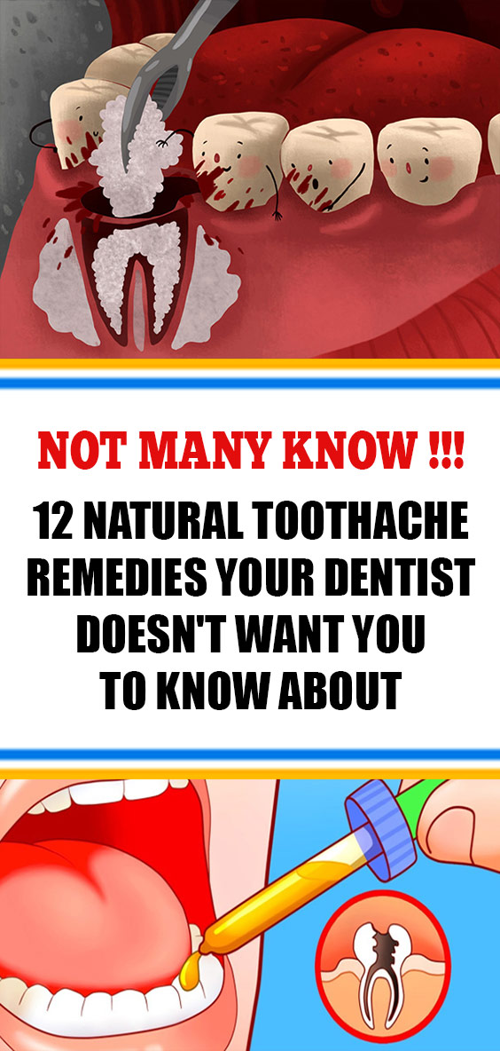 home remedies for toothache