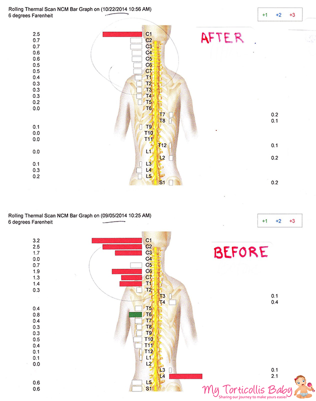 Ausweichen Blaze Zivilisation rolling thermal scan ncm bar graph Inhalt