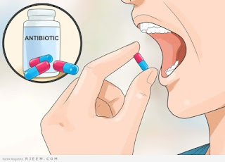 Image OBAT KAPSUL MINUM SIPILIS YANG MANJUR
