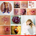 Gambar Benjolan Wasir Di Pantat Alias Bokong thumbnail