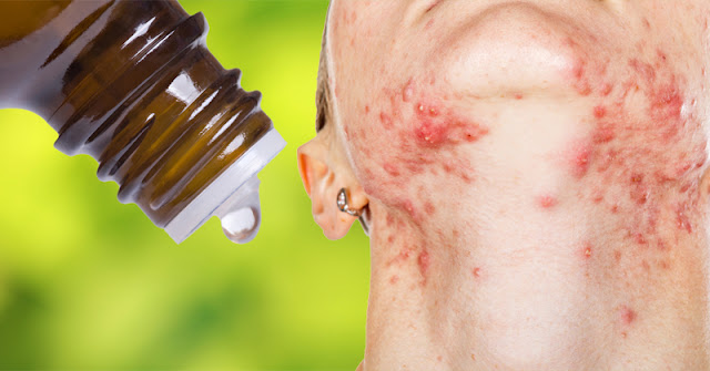 Natural Progesterone Oil No Preservatives Natural Progesterone Oil No Preservatives