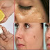 BEST HOME REMEDIES TO REMOVE DARK SPOTS PERMANENTLY