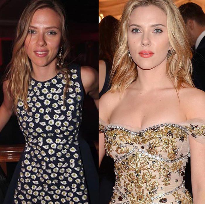 Scarlett Johansson Plastic Surgery Before And After Nose Job And.