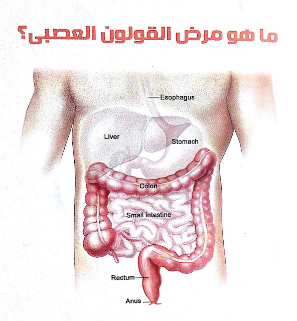 ما هو مرض القاولون العصبي ؟