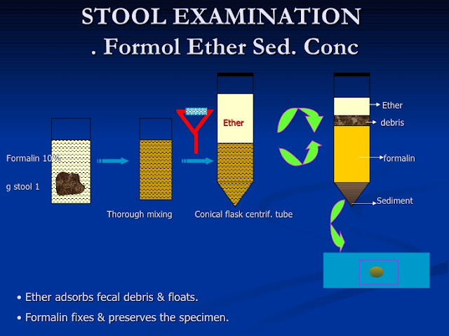 Formol ether concentration technique pdf viewer
