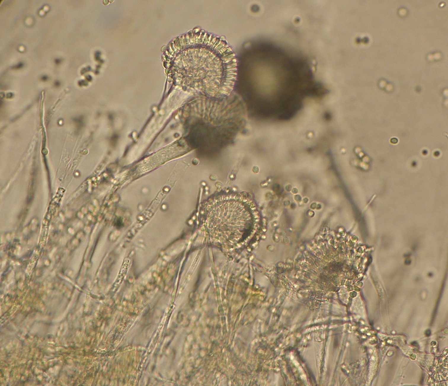Обнаружены споры и мицелий. Грибы Aspergillus flavus. Aspergillus Glaucus мицелий. Aspergillus fumigatus микроскоп. Aspergillus oryzae грибы.