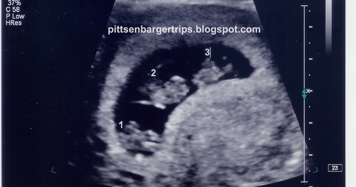 Methods for Estimating the Due Date - ACOG