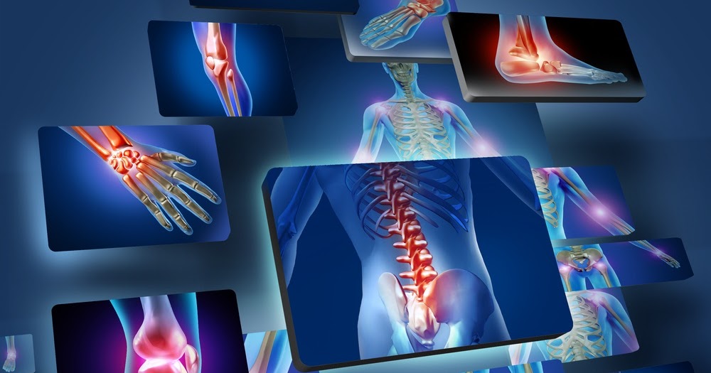 Arthritis Treatment Lahore arthritis treatment lahore