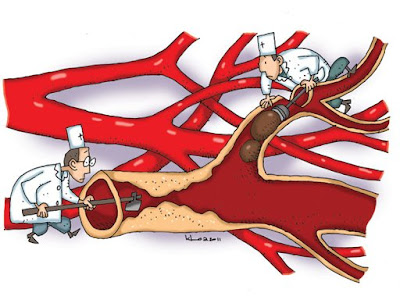 Hoạt huyết, thông mạch là tác dụng nổi bật của bạch quả- ginkgo biloba Hoạt huyết, thông mạch là tác dụng nổi bật của bạch quả- ginkgo biloba