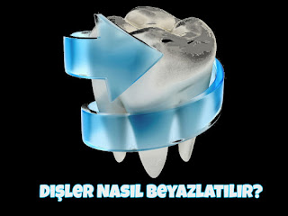 dişler nasıl beyazlatılır