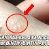 JANGAN Abaikan Jika Anda SERING Melihat BINTIK-BINTIK AIR DI JARI, WAJIB BACA !